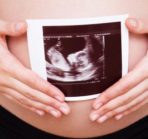 סקירת מערכות פרטית